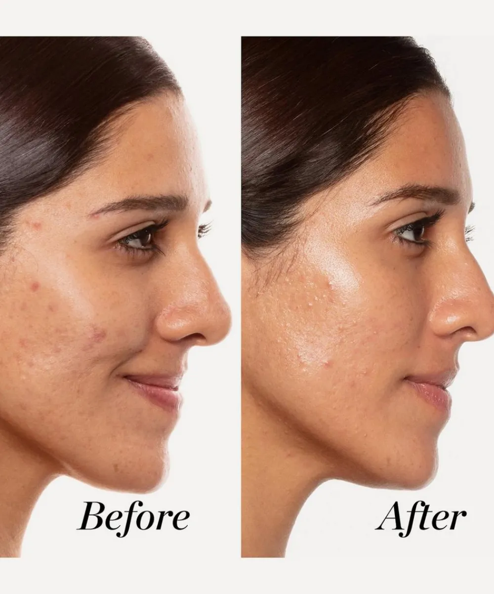 Sunday Riley Facial Serums & Oils^A+ High Dose Retinoid Serum 30ml