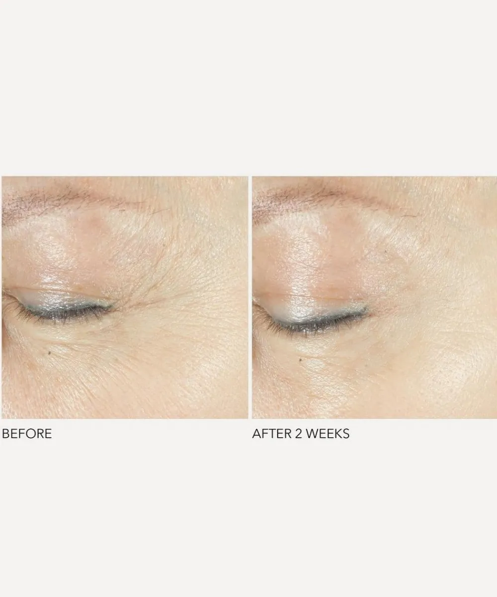 Dr. Dennis Gross Skincare Skin Concern|Facial Serums & Oils^Advanced Retinol + Ferulic Triple Correction Eye Serum 15ml