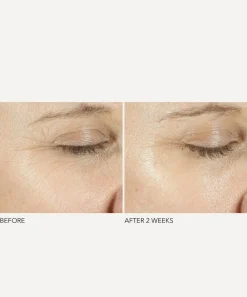Dr. Dennis Gross Skincare Skin Concern|Facial Serums & Oils^Advanced Retinol + Ferulic Triple Correction Eye Serum 15ml