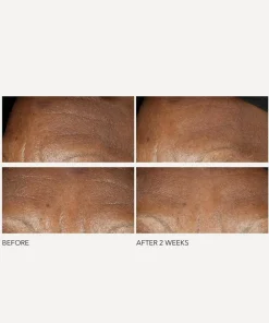Dr. Dennis Gross Skincare Skin Concern|Moisturisers^Advanced Retinol + Ferulic Intense Wrinkle Cream 60ml