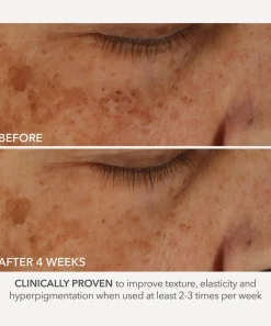 Dr. Dennis Gross Skincare Cleansers & Toners^Advanced Retinol and Ferulic Perfectly Dosed Treatment Pack of 8