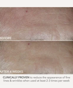 Dr. Dennis Gross Skincare Cleansers & Toners^Advanced Retinol and Ferulic Perfectly Dosed Treatment Pack of 8