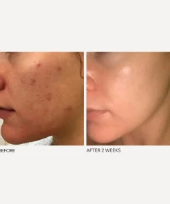 Dr. Dennis Gross Skincare Skin Concern|Masks & Exfoliators^Alpha Beta Extra Strength Daily Peel 30 Pack