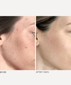 Dr. Dennis Gross Skincare Skin Concern|Masks & Exfoliators^Alpha Beta Universal Daily Peel 60 Pack