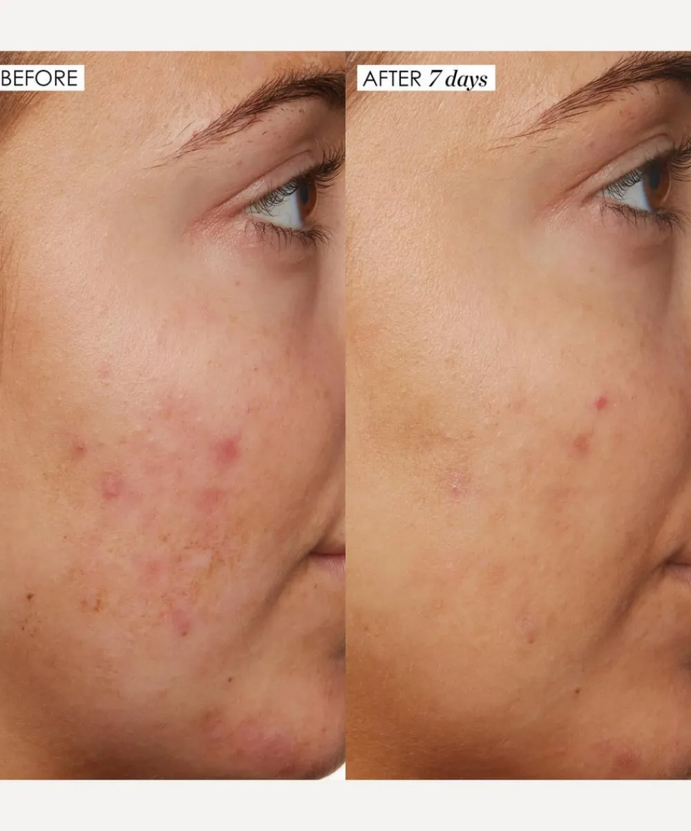 Sunday Riley Facial Serums & Oils^B3 Nice 10% Niacinamide Serum 30ml