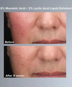 Paula's Choice Masks & Exfoliators^Mandelic and Lactic Acid AHA Liquid Exfoliant 30ml