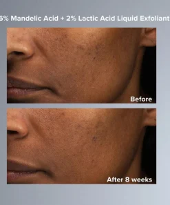 Paula's Choice Masks & Exfoliators^Mandelic and Lactic Acid AHA Liquid Exfoliant 30ml