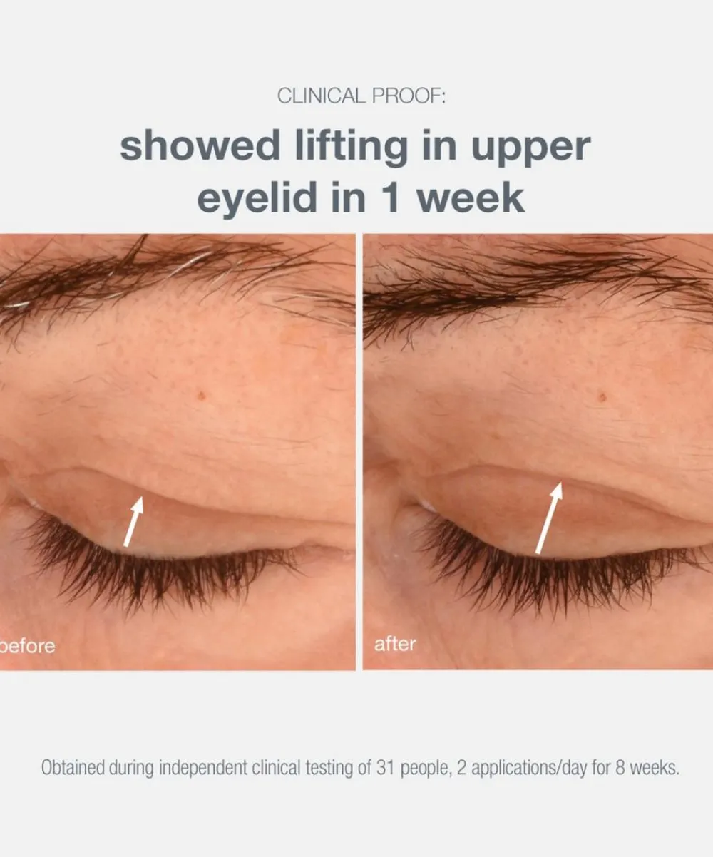 Dermalogica Moisturisers^Phyto Nature Lifting Eye Cream 15ml