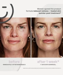Kate Somerville Facial Serums & Oils^SuperCell Rejuvenation Serum 30ml