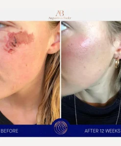 Augustinus Bader Bathroom|Skin Concern^The Cream 50ml