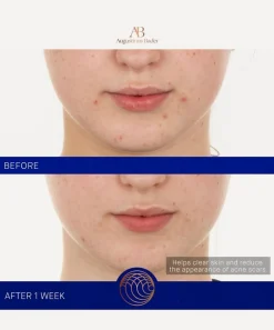 Augustinus Bader Facial Serums & Oils^The Retinol Serum 30ml