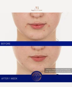 Augustinus Bader Facial Serums & Oils^The Retinol Serum 15ml