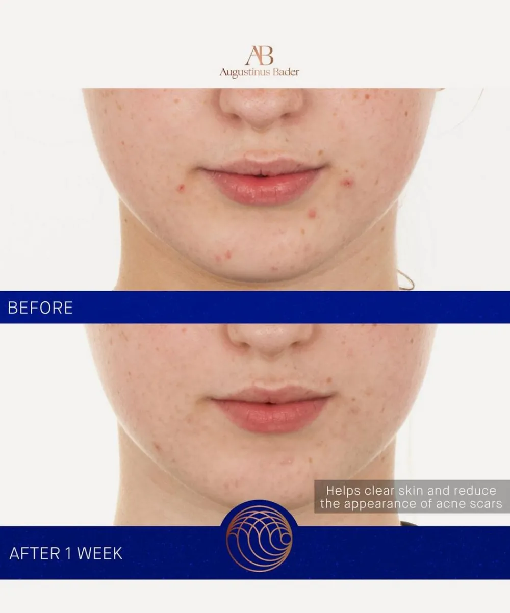 Augustinus Bader Facial Serums & Oils^The Retinol Serum 15ml