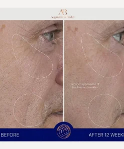 Augustinus Bader Skin Concern|Facial Serums & Oils^The Serum Complete Set 30ml